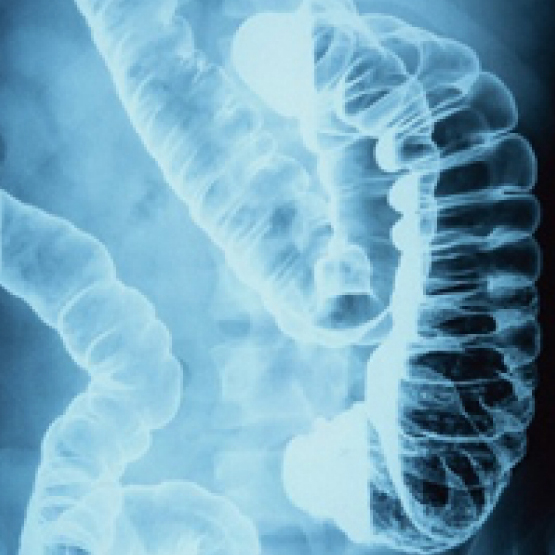 大腸のレントゲン撮影